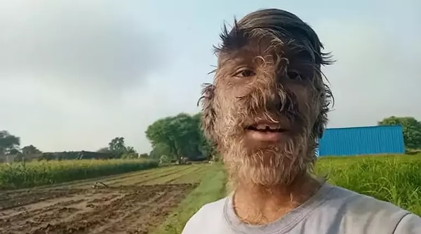 Bilim insanlarının 62 farklı memeli türünü karşılaştırdığı bir araştırma, tüylenmeyi kontrol eden genlere ışık tuttu.