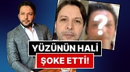 Yüzünü Görenler Şoke Oldu: Kaşlarına İşlem Yaptıran Nihat Doğan'ın Son Hali Tatları Fena Halde Kaçırdı!