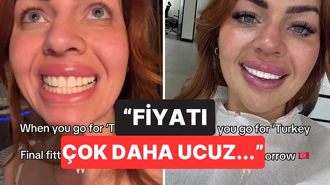 Türkiye'de Daha Ucuzmuş: Diş Estetiği Yaptırmak İçin Türkiye'nin Yolunu Tutan Kadından İlginç Açıklamalar
