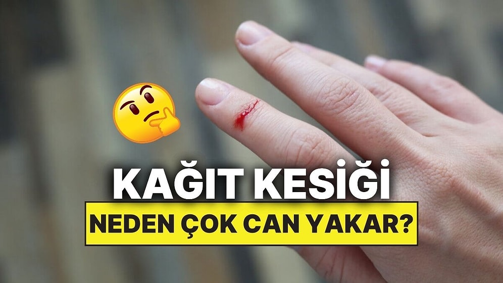 Kağıt Kesiği Neden Bu Kadar Çok Canımızı Acıtır?
