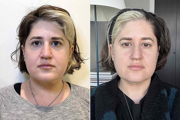 Fotoğrafla Güzellik Analizi Yaparken Nelere Dikkat Etmeli?