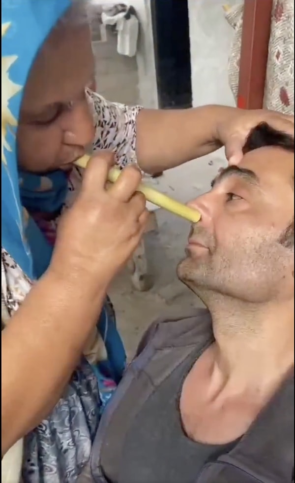 Sosyal medyada bugün karşımıza çıkan bir videoda, Adanalı bir teyzemizin benzer şekilde yaptığı tedaviye denk geldik.