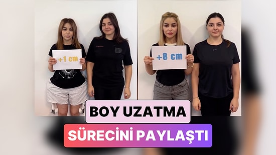 Boy Uzatma Operasyonu Geçiren Bir Kadın Günden Güne Yaşadığı Değişimi Paylaştı