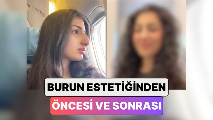 Bir Kadın Çok İstediği Burun Estetiği Yaptırdıktan Sonra Yaşadığı Değişimi Paylaştı