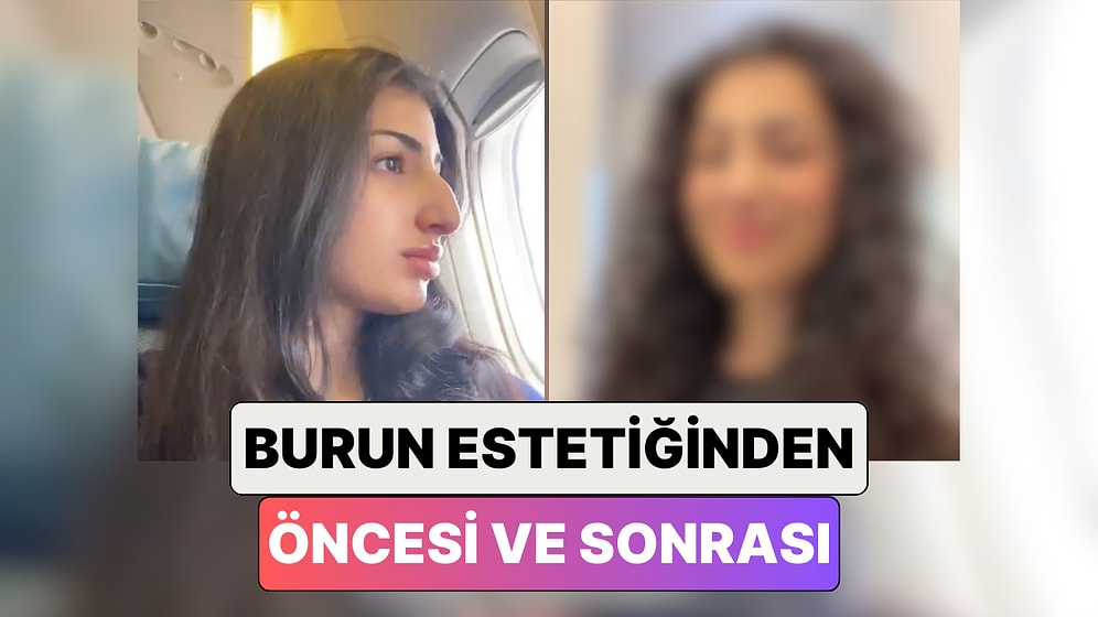 Bir Kadın Çok İstediği Burun Estetiği Yaptırdıktan Sonra Yaşadığı Değişimi Paylaştı