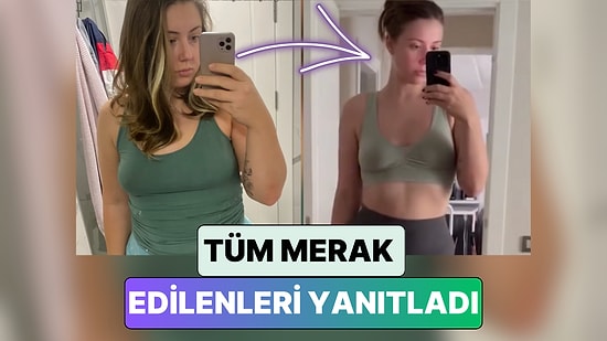 Tüp Mide Ameliyatı Olan Bir İçerik Üreticisi Süreçle İlgil Merak Edilen Tüm Soruları Yanıtladı