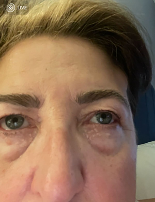 Bir aile pikniğinde, Jayne sonunda yıllardır rahatsız olduğu bu sorunu çözmeye karar verdi. "Bir akrabamın gözleri harika görünüyordu, çok doğal duruyordu," diye hatırlıyor.