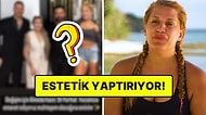 Estetikliler Kervanına Katıldı: Survivor Almeda Elenir Elenmez Soluğu Orada Aldı!