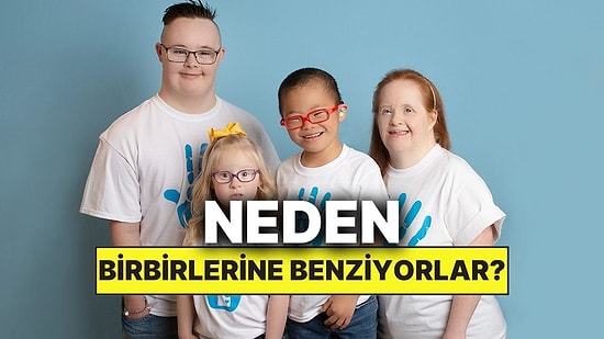 Down Sendromlu Bireyler Neden Birbirine Benzer?