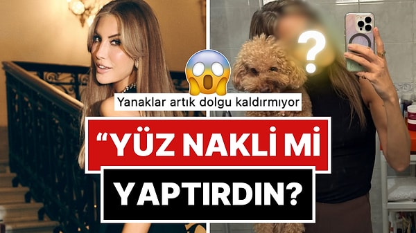 Artık Yeter: Çağla Şikel'in Son Pozu "Bu Kim?" Dedirtti!