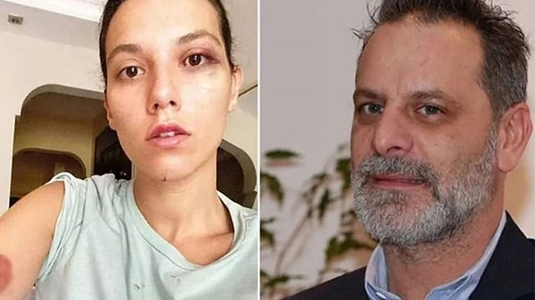 Oyuncu Ozan Güven, eski sevgilisi Deniz Bulutsuz'a yönelik şiddet iddialarıyla gündeme gelmişti. Görseli