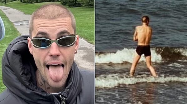 Sevenlerini korkutan ve zayıflığıyla dikkat çeken Justin Bieber bu sefer de dökülen saçlarıyla odak noktası oldu.
