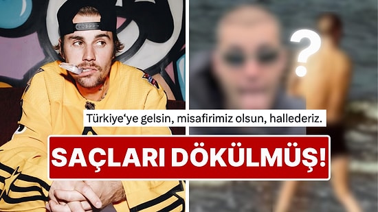 Eski Halinden Eser Kalmadığı Gibi Her Gördüğümüzde Ayrı Çöken Justin Bieber 31 Yaşında Kel Kaldı!