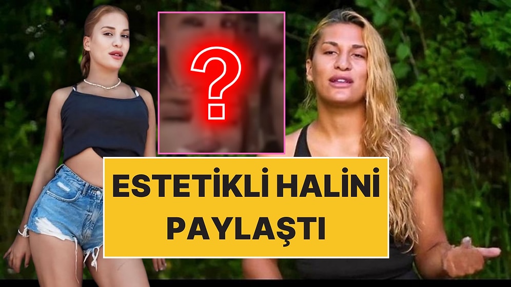 Survivor'dan Elendikten Sonra Estetik Doktoruna Koşmuştu: Almeda Baylan'dan Ameliyat Sonrası İlk Kare!