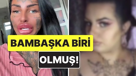 "Eski Hali Daha İyiydi": Estetik Yaptırmadan Önceki Halini Paylaşan Influencer Şoke Etti
