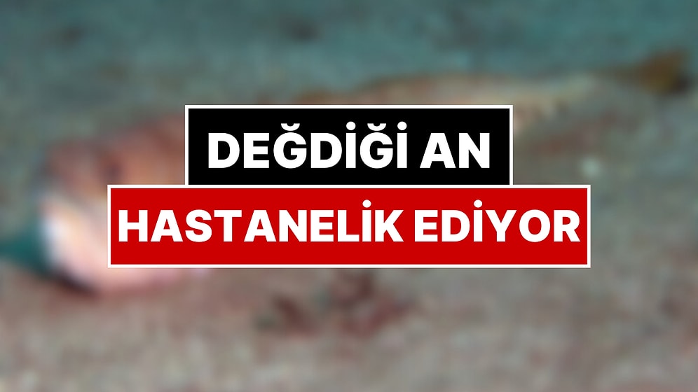 Kollarda Çürüme, Dokuda Ölüm: Bu Balığı Görenler Dikkat! Değdiği An Hastanelik Ediyor