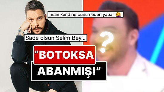 Estetikten Geri Kalmamış: Sinan Akçıl'ın Botoks ve Dolgularla Şişen Yüzünün Son Hali Dillere Fena Düştü!