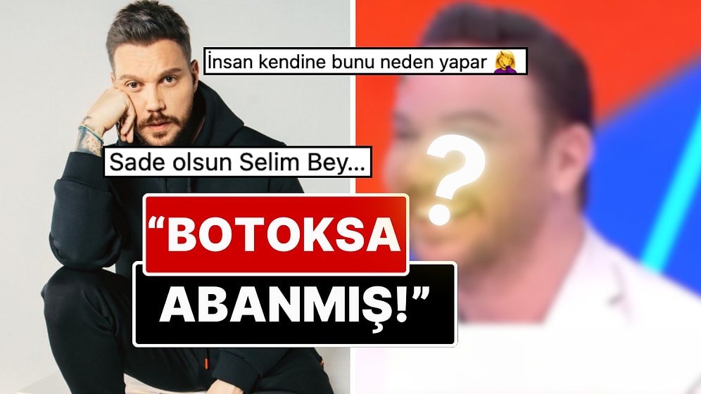 Estetikten Geri Kalmamış: Sinan Akçıl'ın Botoks ve Dolgularla Şişen Yüzünün Son Hali Dillere Fena Düştü!
