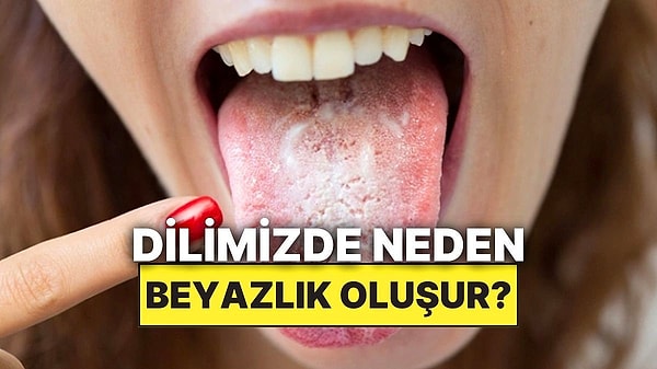 6. Dilimizin Arka Kısımlarında Oluşan Bu Beyazlığın Sebebi Nedir?