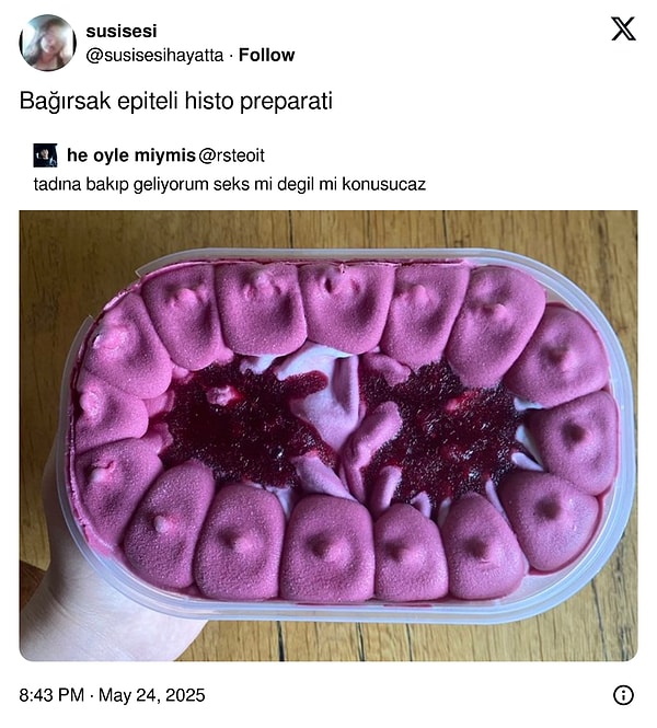 Aynen o dediğinden.
