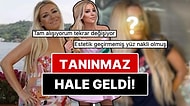 Estetik Ameliyatlarla Resmen Yüz Nakli Geçiren Gülşah Saraçoğlu 9 Saatlik Operasyonla Tanınmaz Hale Geldi!