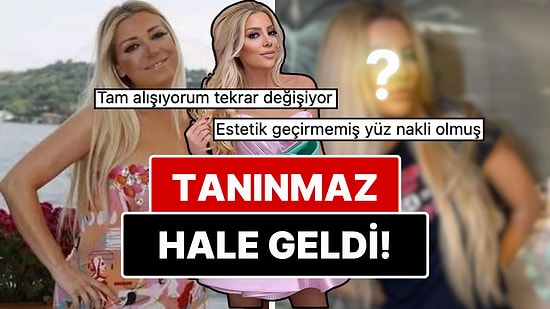 Estetik Ameliyatlarla Resmen Yüz Nakli Geçiren Gülşah Saraçoğlu 9 Saatlik Operasyonla Tanınmaz Hale Geldi!