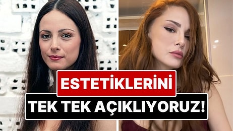 Yıllar İçinde Bambaşka Biri Olmuş: Mine Tugay'ın Estetik İşlemlerini Eski Haliyle Karşılaştırarak Açıklıyoruz!