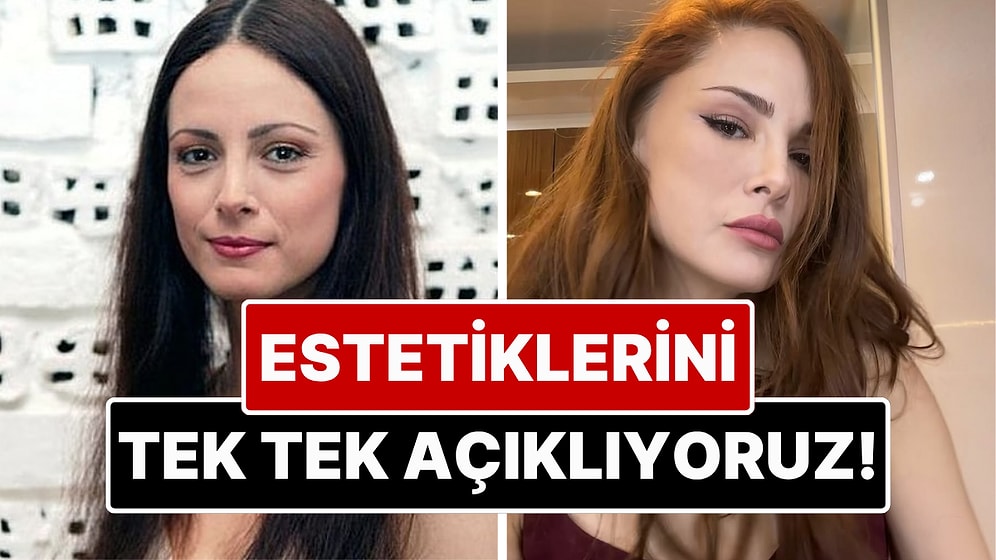 Yıllar İçinde Bambaşka Biri Olmuş: Mine Tugay'ın Estetik İşlemlerini Eski Haliyle Karşılaştırarak Açıklıyoruz!