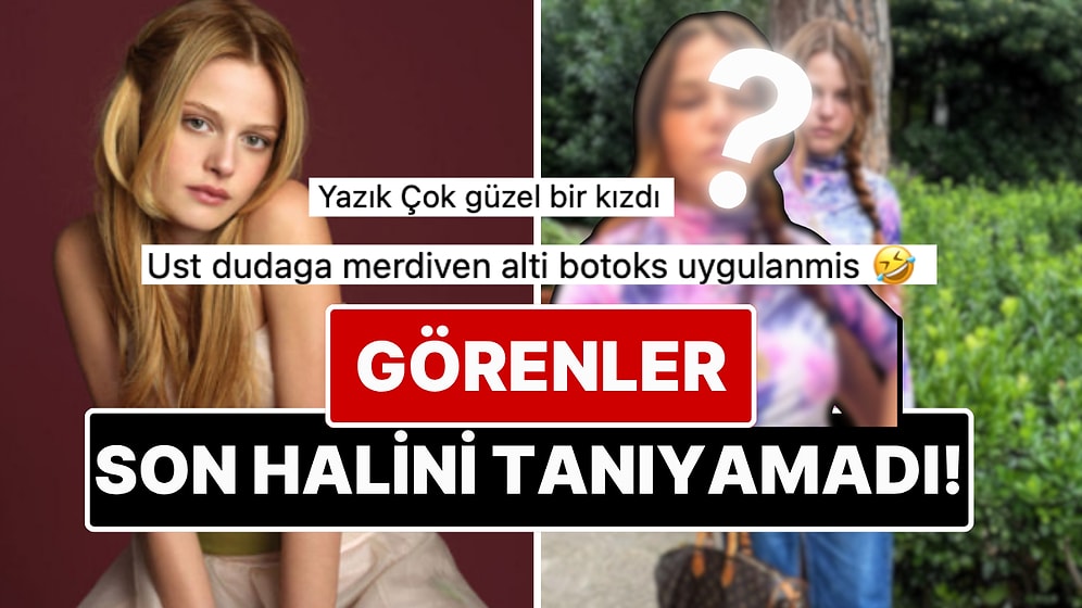41 Yaşındaki Naz Elmas'ın Filtreyle Kendini Resmen Çocuğa Dönüştürdüğü Pozlar Dillere Büyük Düştü!