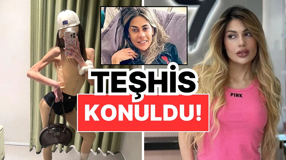 37 Kiloya Kadar Düşen Nihal Candan’ın Sağlık Durumu Kötüye Gidiyor: Organ Yetmezliği Teşhisi!