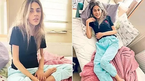 2. Hastalığı yüzünden 29 kiloya kadar düşmüştü. Görseli