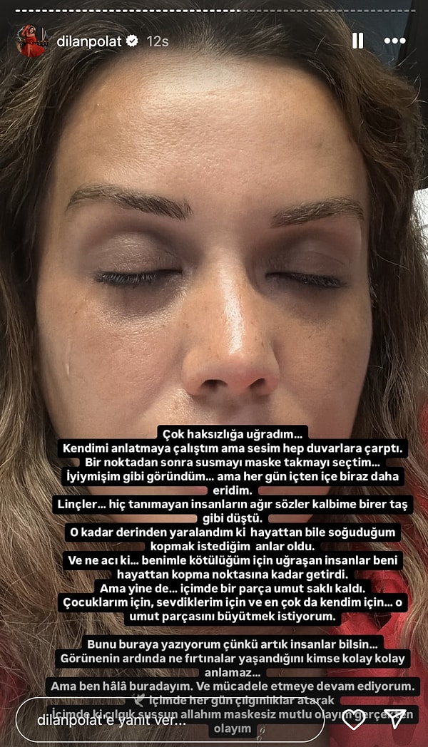 Hastanede kaldığı süre boyunca sosyal medya hesabını aktif kullanmaya devam eden Dilan Polat, oğlunun mezuniyetine katıldığını ancak hemen ardından tedavi sürecine başladığını dile getirdi.