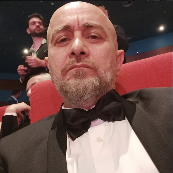 Şimdi siz karar verin: Semih'in saçlı hali mi yoksa Murat Garipağaoğlu'nun doğal ve kel hali mi?