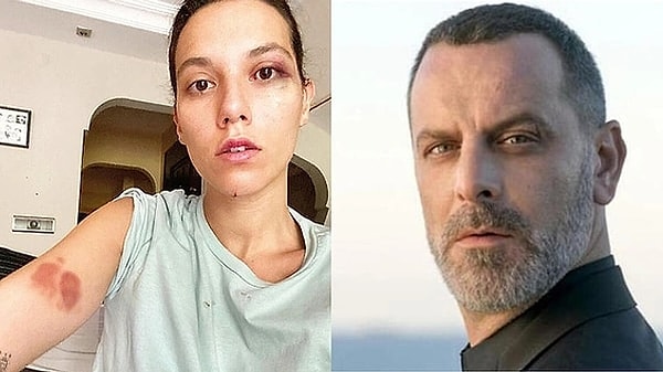 Deniz Bulutsuz nie milczał w sprawie wyroku więzienia Ozana Güvena!