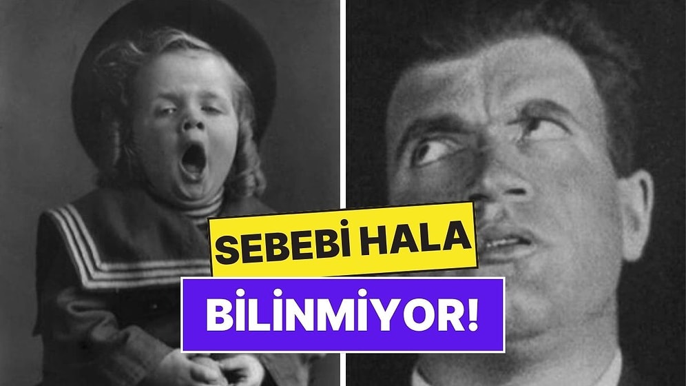 100 Yıl Önce Ortaya Çıkıp Binlerce Kişiyi Etkileyen "Uyuyan Salgın": Encephalitis Lethargica