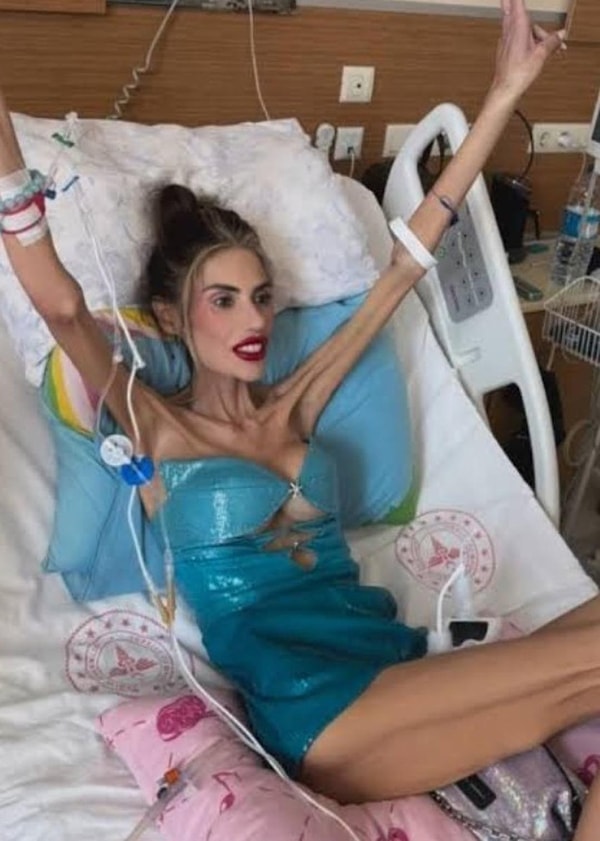 Anoreksiya tedavisi gören Nihal Candan 25 kg'a düştükten sonra devlet hastanesinin yoğun bakım bölümüne kaldırılmıştı Görseli