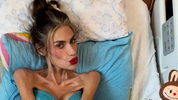 Sosyal medya fenomeni Nihal Candan, yaşam savaşını kaybetti. Görseli