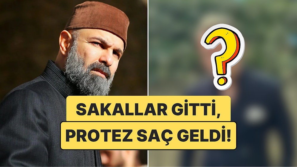 Sakallar Gitti, Protez Saç Geldi: Erkan Avcı’nın Yeni Dizi İmajı Görenleri Şaşkına Uğrattı!