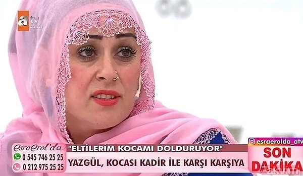 Türkiye’nin önde gelen saç uzmanlarından Serkan Aydın’la bir araya gelen Yazgül Bayat, klinikte yapılan işlemle 5500 greft saç ektirdi.