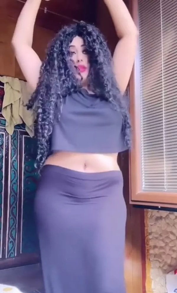 Daha önce karın germe ve çeşitli estetik operasyonlar geçiren Yazgül, sosyal medya hesabından yaptığı “Shakira oldum” paylaşımıyla dikkat çekmişti.