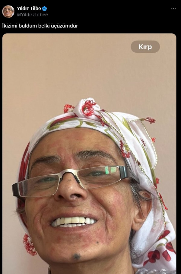 Yıldız Tilbe'nin paylaşımında yüzündeki lekeler de dikkatlerden kaçmadı👇