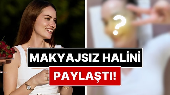Doğal Yüzü Dikkat Çekti: Estetik İddialarını Yalanlayan Fahriye Evcen Makyajsız Halini Paylaştı!