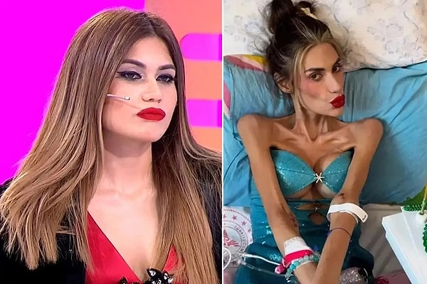 Bir süredir anoreksiya nevroza hastalığıyla mücadele eden Nihal Candan, geçtiğimiz günlerde yaşam savaşını kaybetti.