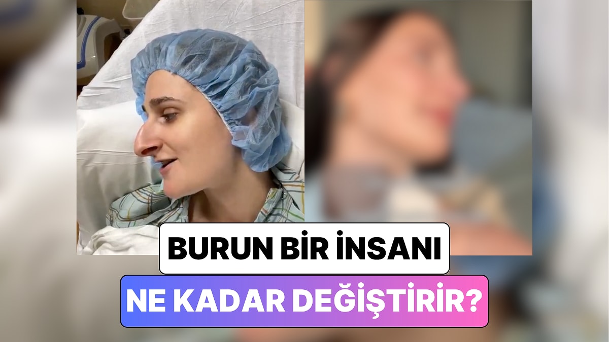 Bir Kadın Geçirdiği Burun Estetiği Operasyonundan Sonra Yaşadığı Değişimi Paylaştı