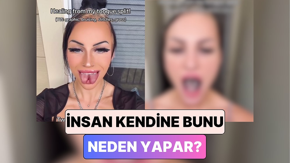 İlginç Moda Akımı Uğruna Dilini İkiye Böldüren Kadın Dilinin Zamanla Geldiği Hali Paylaştı