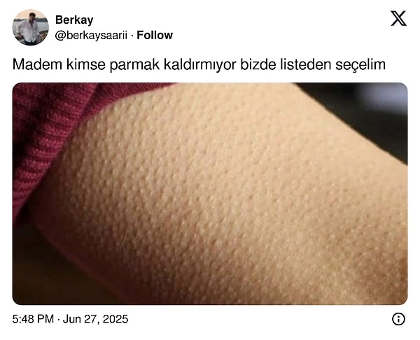 Tüyler diken diken...