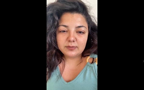Bu olay, estetik kaygıların toplumda ne denli baskın hale geldiğinin çarpıcı bir göstergesi.