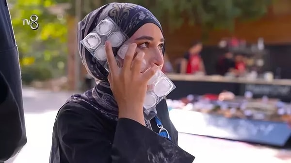 MasterChef 2024'ün en korkutan olaylarından biri yarışmacılardan Beyza'nın dış çekim oyununda yüzünü yakması olmuştu.
