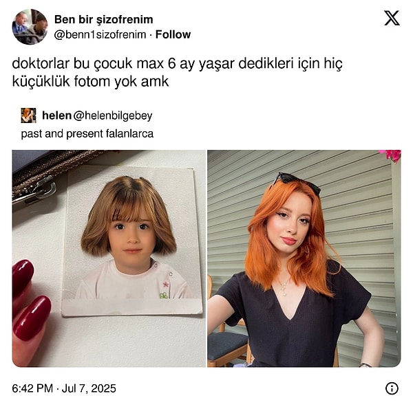 Üzdü...