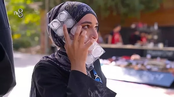MasterChef 2024'ün en korkutan olaylarından biri yarışmacılardan Beyza'nın dış çekim oyununda yüzünü yakması olmuştu.